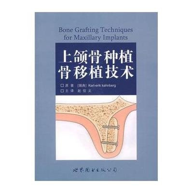 上颌骨种植骨移植技术